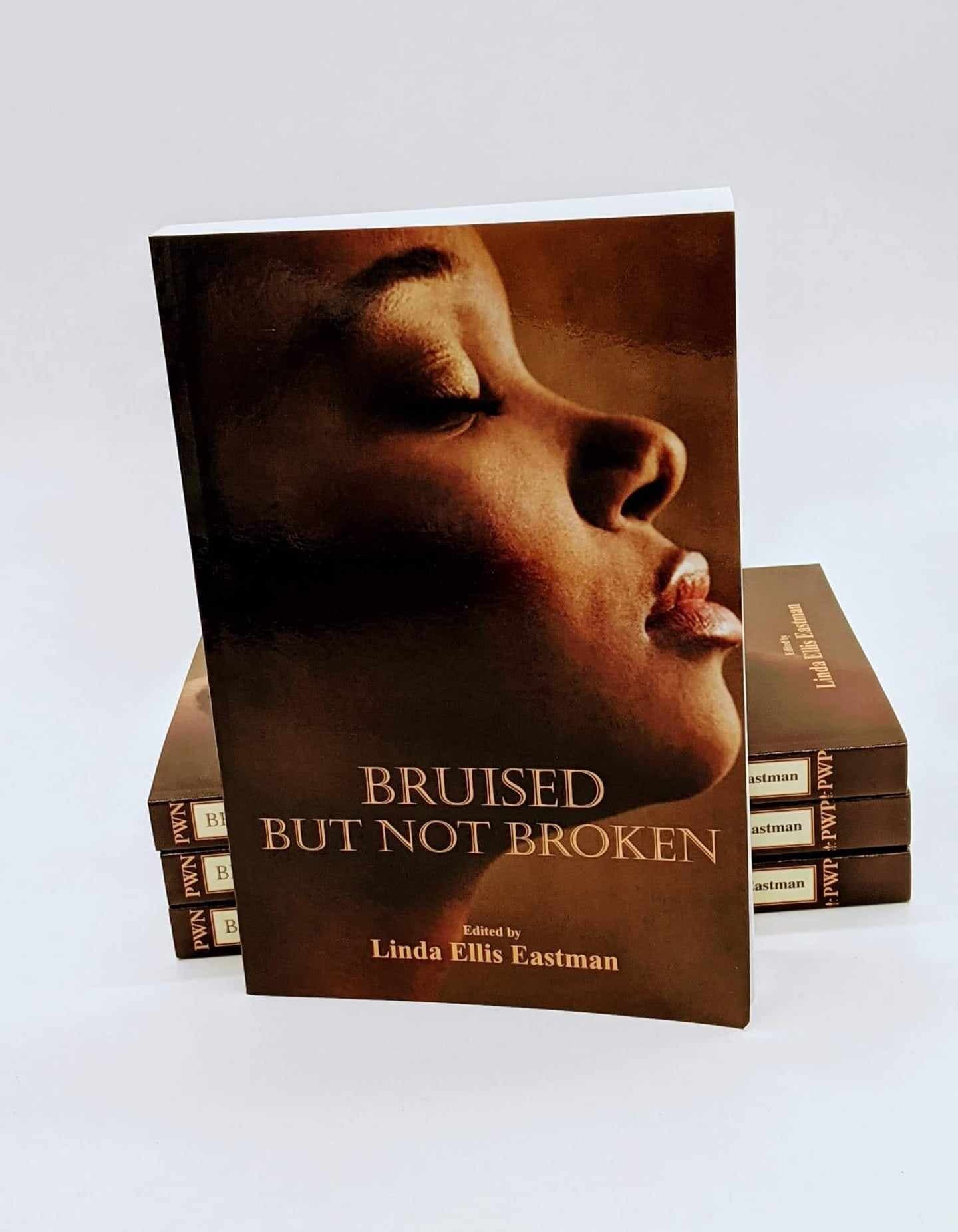 Bruised But Not Broken book cover